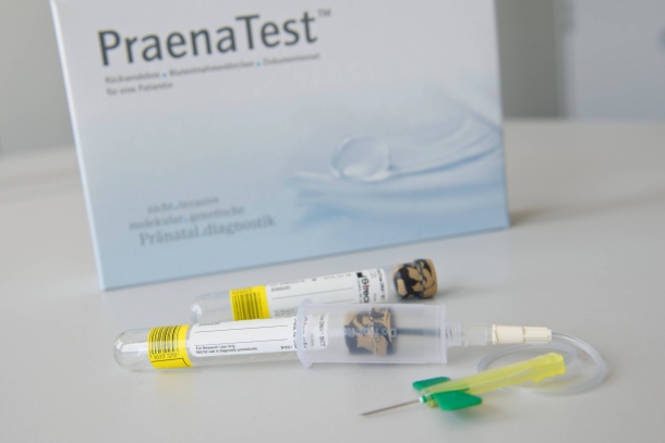 der-praena-test-gilt-als-individuelle-gesundheitsleistung-die-kosten-traegt-die-schwangere-selbst